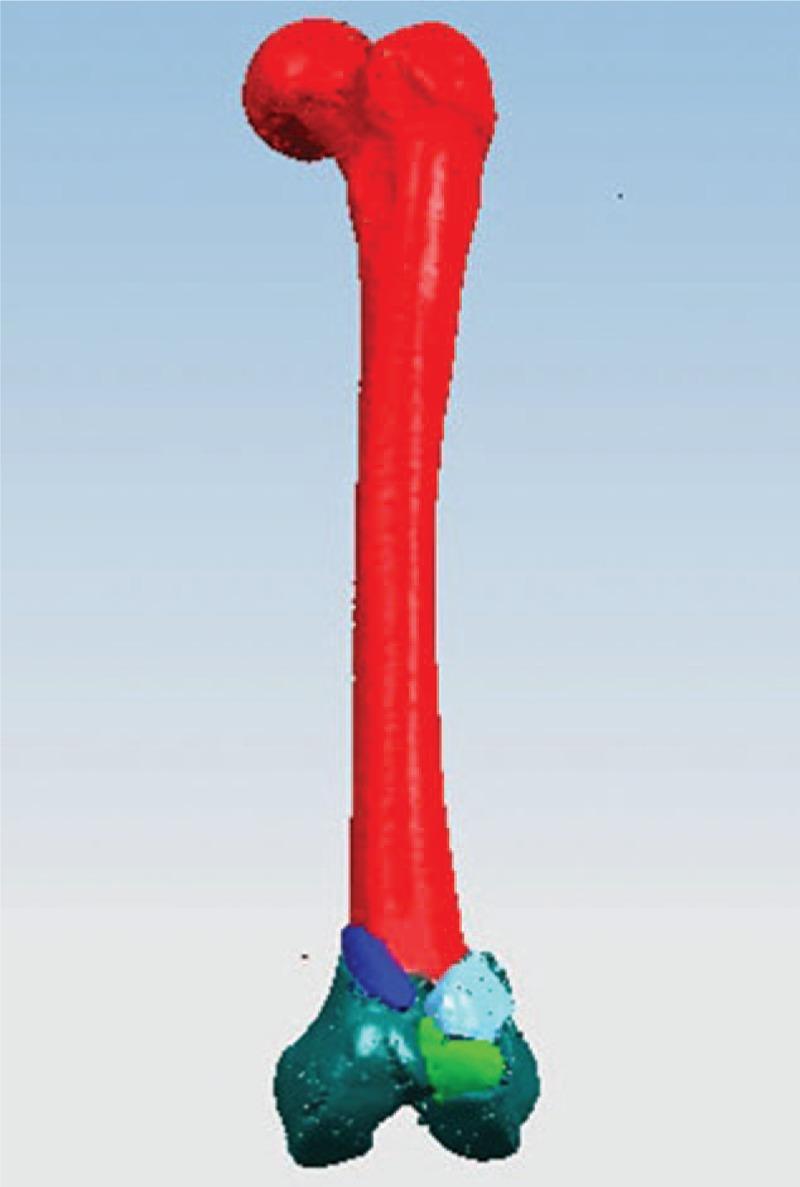 https://cdn.ncbi.nlm.nih.gov/pmc/blobs/edd7/5556238/fa823b8397b9/medi-96-e7770-g002.jpg