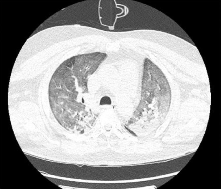 https://cdn.ncbi.nlm.nih.gov/pmc/blobs/edd7/7405863/0b059f9371ca/gr1_lrg.jpg