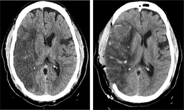 https://cdn.ncbi.nlm.nih.gov/pmc/blobs/edd7/7405863/aaabd3d94a55/gr2_lrg.jpg