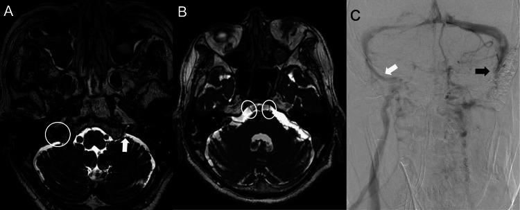 https://cdn.ncbi.nlm.nih.gov/pmc/blobs/eddb/11466548/7ace23858508/cureus-0016-00000069120-i04.jpg
