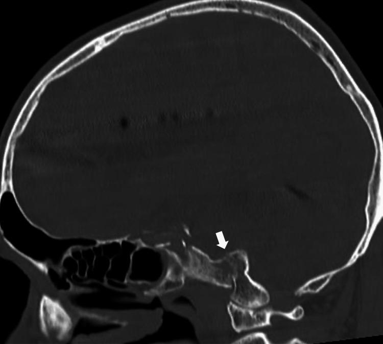 https://cdn.ncbi.nlm.nih.gov/pmc/blobs/eddb/11466548/f8394f642771/cureus-0016-00000069120-i05.jpg
