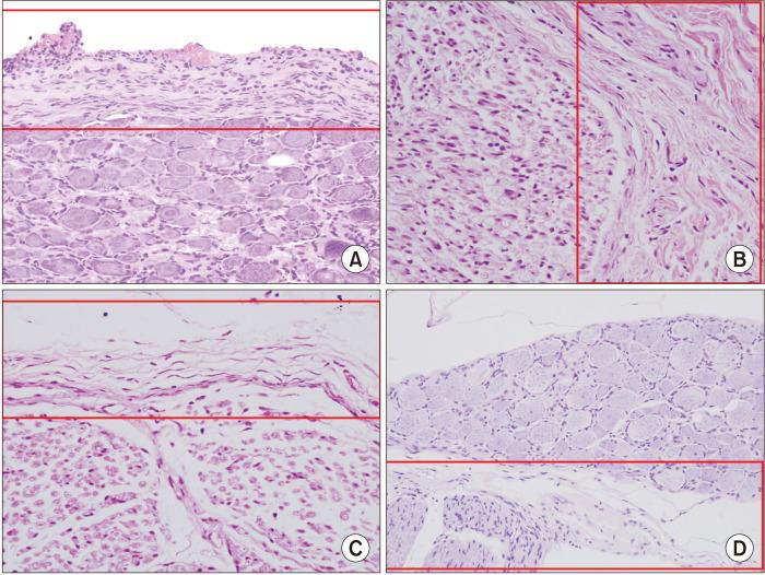 https://cdn.ncbi.nlm.nih.gov/pmc/blobs/ede0/8494961/2d047b41e299/kjp-34-4-394-f5.jpg