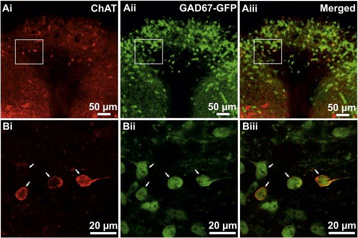 https://cdn.ncbi.nlm.nih.gov/pmc/blobs/ede9/4658331/ec2f371eaa9a/gr4.jpg