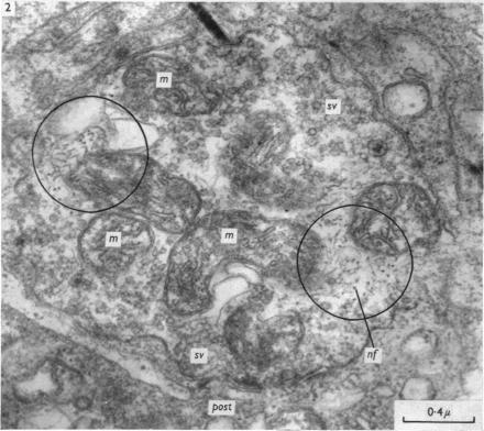 https://cdn.ncbi.nlm.nih.gov/pmc/blobs/edeb/1359996/f85517b9d909/jphysiol01262-0179-b.jpg