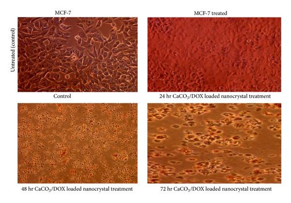 https://cdn.ncbi.nlm.nih.gov/pmc/blobs/edf6/4084513/6a2caaa490b6/BMRI2014-391869.009.jpg