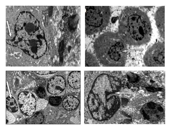 https://cdn.ncbi.nlm.nih.gov/pmc/blobs/edf6/4084513/73406cdeeb96/BMRI2014-391869.013.jpg