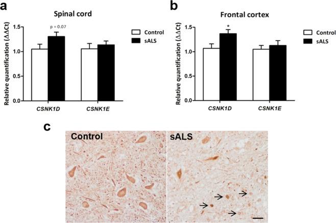 https://cdn.ncbi.nlm.nih.gov/pmc/blobs/edf7/7064575/86a5ffd9f0a0/41598_2020_61265_Fig6_HTML.jpg