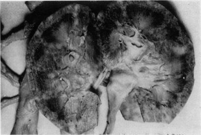 https://cdn.ncbi.nlm.nih.gov/pmc/blobs/ee00/2467058/6aa95fd270fc/postmedj00355-0049-a.jpg