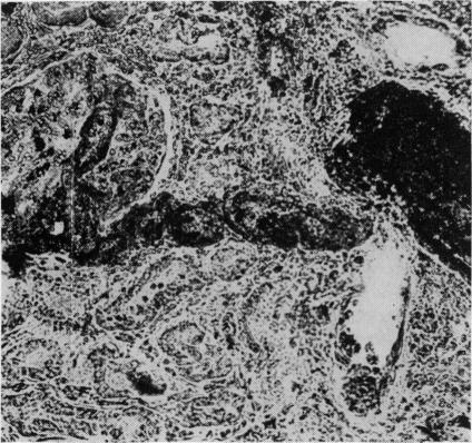 https://cdn.ncbi.nlm.nih.gov/pmc/blobs/ee00/2467058/f3b02d0c8d1e/postmedj00355-0049-b.jpg
