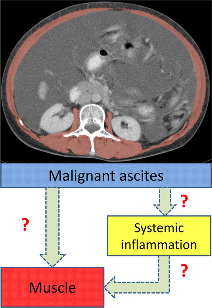 https://cdn.ncbi.nlm.nih.gov/pmc/blobs/ee09/10570096/16536f96a6e1/JCSM-14-2114-g001.jpg