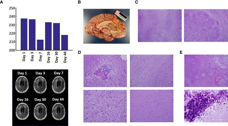 https://cdn.ncbi.nlm.nih.gov/pmc/blobs/ee18/8341943/fda2a65cac5e/fonc-11-708017-g003.jpg