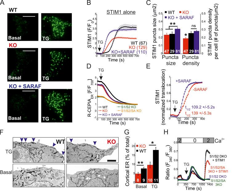 https://cdn.ncbi.nlm.nih.gov/pmc/blobs/ee1a/8562847/6bf8e69cca20/JCB_202104007_Fig2.jpg