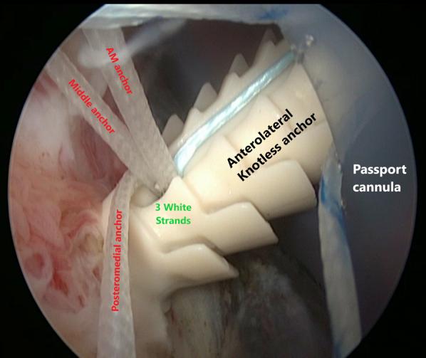 https://cdn.ncbi.nlm.nih.gov/pmc/blobs/ee24/7823101/bd7a92f42441/gr15.jpg