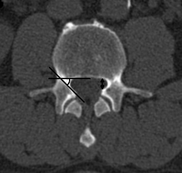 https://cdn.ncbi.nlm.nih.gov/pmc/blobs/ee27/3161920/2d19c511391a/1471-2474-12-175-7.jpg