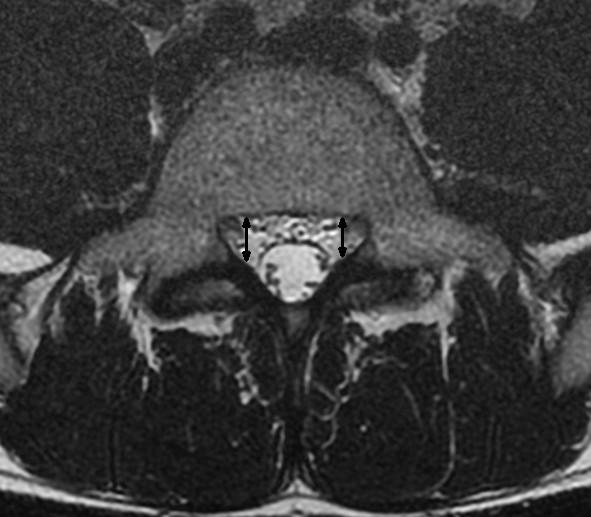 https://cdn.ncbi.nlm.nih.gov/pmc/blobs/ee27/3161920/6e53a9b52600/1471-2474-12-175-6.jpg