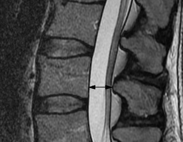 https://cdn.ncbi.nlm.nih.gov/pmc/blobs/ee27/3161920/d64d5db0e958/1471-2474-12-175-3.jpg