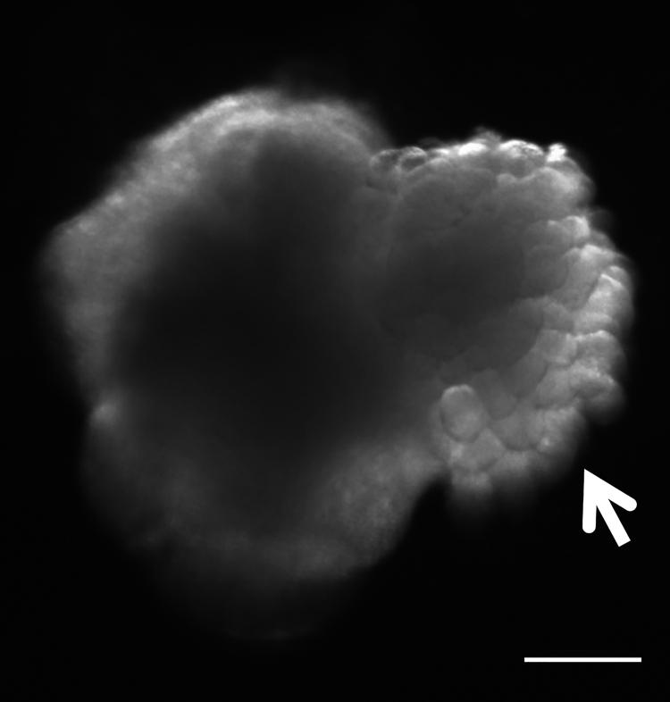 https://cdn.ncbi.nlm.nih.gov/pmc/blobs/ee2d/8102160/11361d4caf6c/gr4.jpg