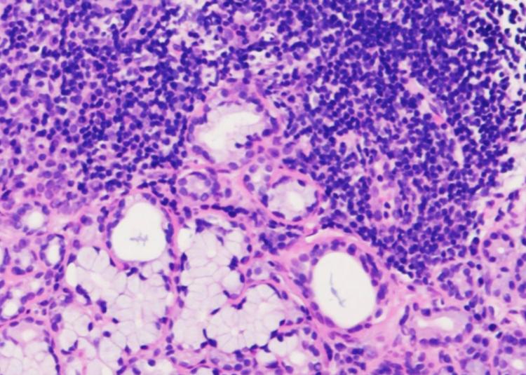 https://cdn.ncbi.nlm.nih.gov/pmc/blobs/ee2d/8102160/f4639d058a0f/gr1.jpg