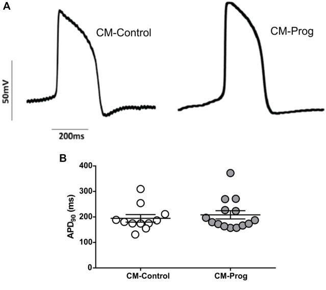 https://cdn.ncbi.nlm.nih.gov/pmc/blobs/ee2e/9726722/1df016a07211/fphys-13-1007418-g003.jpg