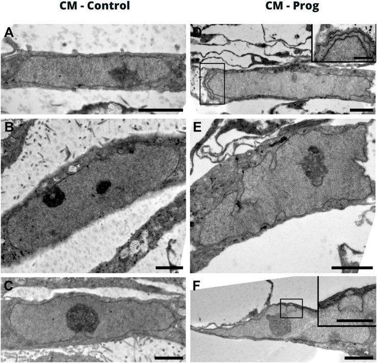 https://cdn.ncbi.nlm.nih.gov/pmc/blobs/ee2e/9726722/43cde9259b9b/fphys-13-1007418-g002.jpg