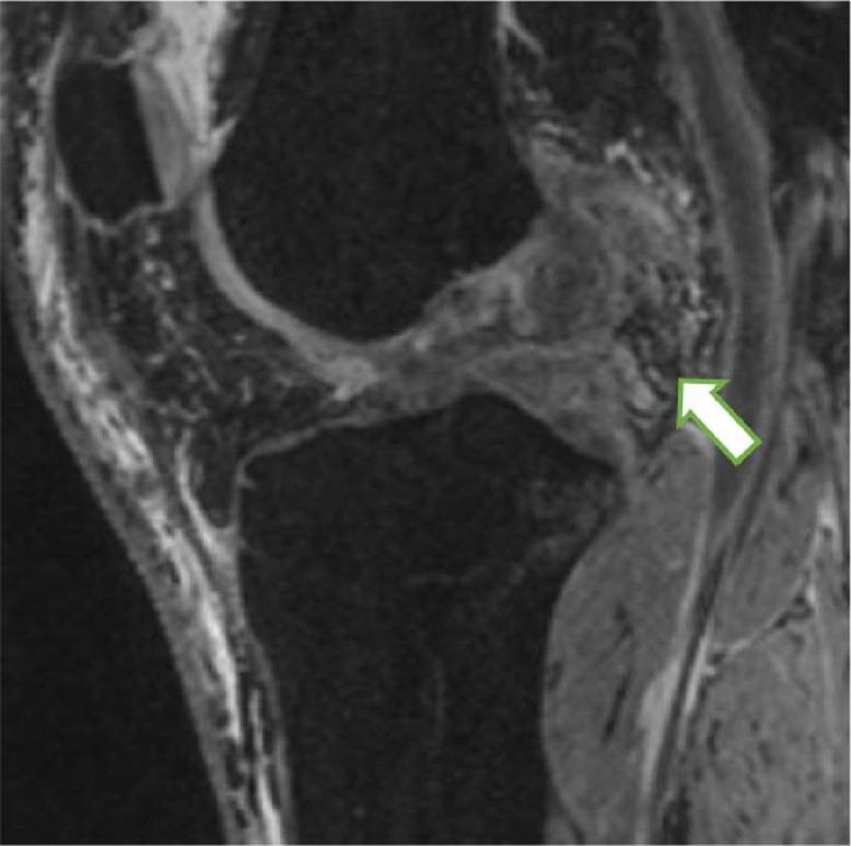 https://cdn.ncbi.nlm.nih.gov/pmc/blobs/ee31/10883784/799b910aa7dc/gr2.jpg