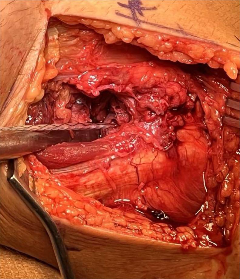 https://cdn.ncbi.nlm.nih.gov/pmc/blobs/ee31/10883784/ee81b3cf0eae/gr9.jpg
