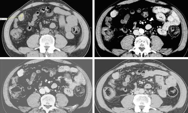 https://cdn.ncbi.nlm.nih.gov/pmc/blobs/ee3d/2827057/632a1f57cd35/1757-1626-0002-0000008982-1.jpg