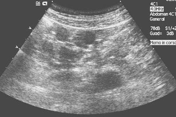 https://cdn.ncbi.nlm.nih.gov/pmc/blobs/ee3d/2827057/9076eb2f3bf4/1757-1626-0002-0000008982-2.jpg