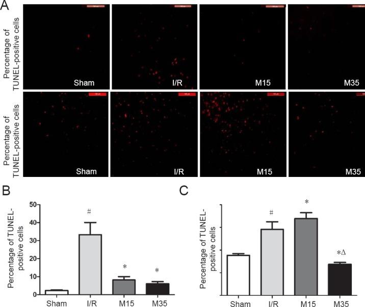 https://cdn.ncbi.nlm.nih.gov/pmc/blobs/ee41/5879897/7a03fef1110d/NRR-13-257-g005.jpg