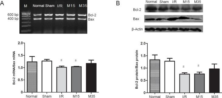 https://cdn.ncbi.nlm.nih.gov/pmc/blobs/ee41/5879897/949799e28efe/NRR-13-257-g006.jpg