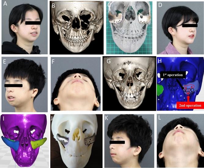 https://cdn.ncbi.nlm.nih.gov/pmc/blobs/ee42/9085892/812fa1e3fcb9/41598_2022_11200_Fig3_HTML.jpg
