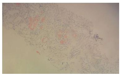 https://cdn.ncbi.nlm.nih.gov/pmc/blobs/ee47/5352960/3da6cffa53d5/WJCC-5-119-g002.jpg