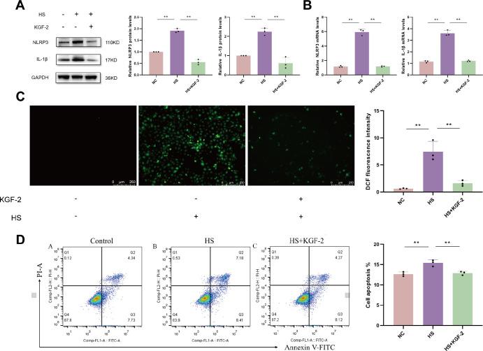 https://cdn.ncbi.nlm.nih.gov/pmc/blobs/ee55/12007672/98e140b8b372/iovs-66-4-28-f001.jpg