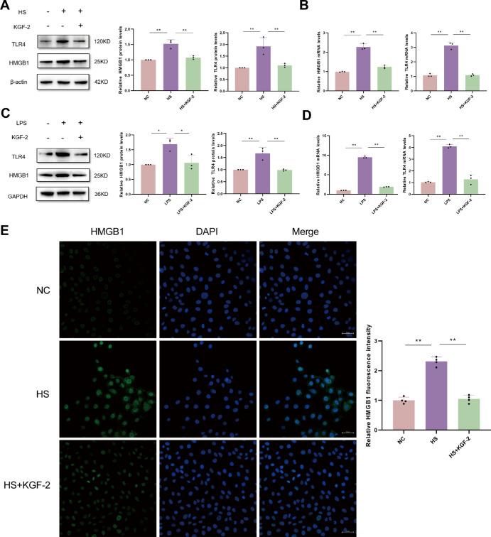https://cdn.ncbi.nlm.nih.gov/pmc/blobs/ee55/12007672/a23a5d183694/iovs-66-4-28-f004.jpg