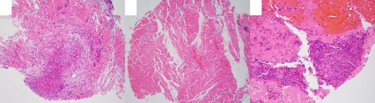 https://cdn.ncbi.nlm.nih.gov/pmc/blobs/ee56/10053638/b6bcce7bb352/ytad090f7.jpg