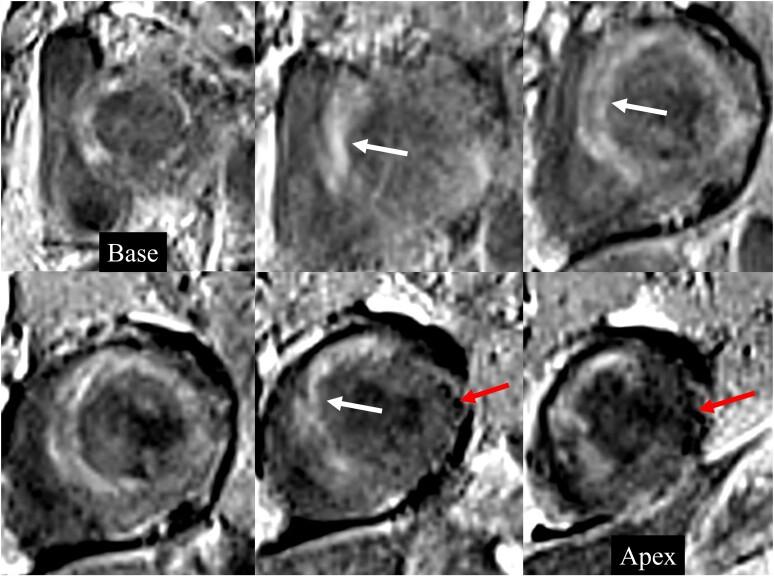 https://cdn.ncbi.nlm.nih.gov/pmc/blobs/ee56/10053638/dfa8ae8ccfce/ytad090f5.jpg