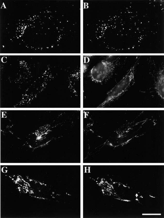 https://cdn.ncbi.nlm.nih.gov/pmc/blobs/ee57/2175136/02d4333481c0/JCB0004035.f3.jpg