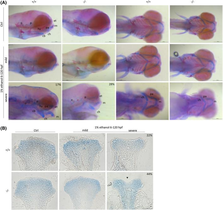 https://cdn.ncbi.nlm.nih.gov/pmc/blobs/ee59/11877993/9ba8d7f8c9ef/DVDY-254-240-g002.jpg