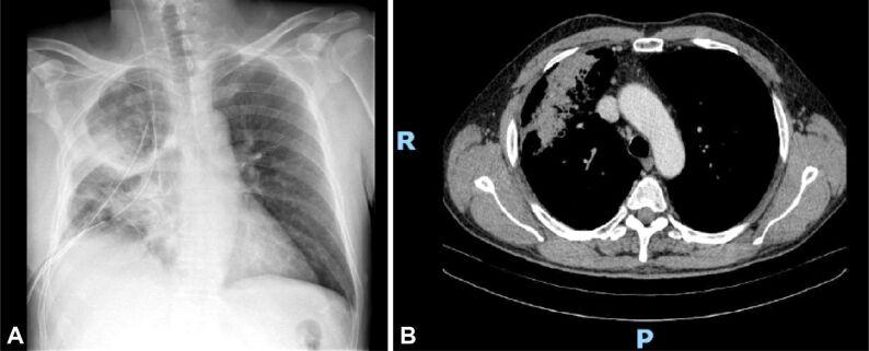https://cdn.ncbi.nlm.nih.gov/pmc/blobs/ee5c/9019611/8eb253fc9248/RJME-62-3-697-fig7.jpg