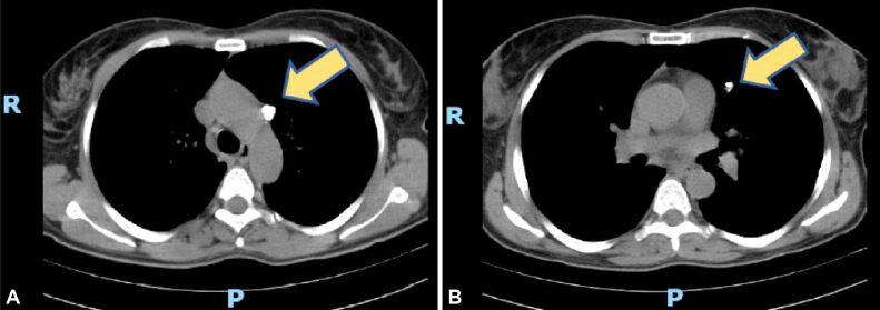 https://cdn.ncbi.nlm.nih.gov/pmc/blobs/ee5c/9019611/f8055ffe79a0/RJME-62-3-697-fig5.jpg