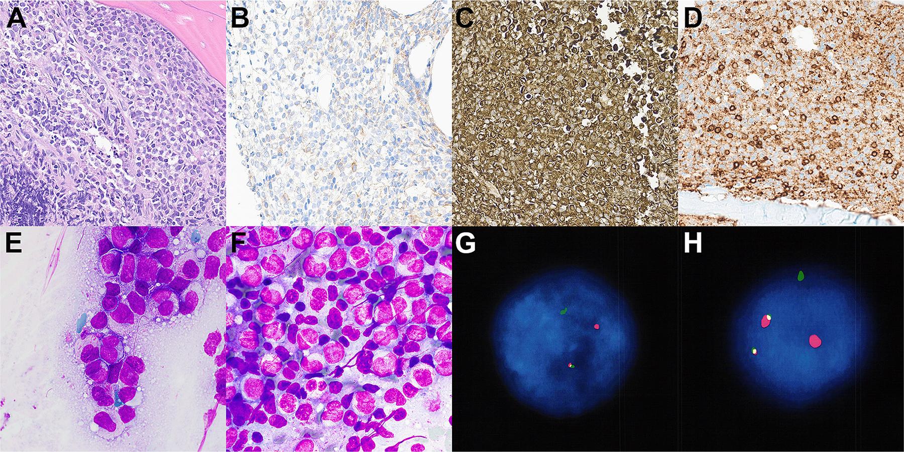 https://cdn.ncbi.nlm.nih.gov/pmc/blobs/ee68/11440618/760fc9901615/nihms-2022596-f0002.jpg