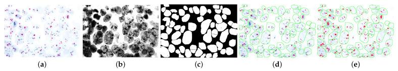 https://cdn.ncbi.nlm.nih.gov/pmc/blobs/ee6e/11430898/5c5ee81d3a14/diagnostics-14-02089-g005.jpg