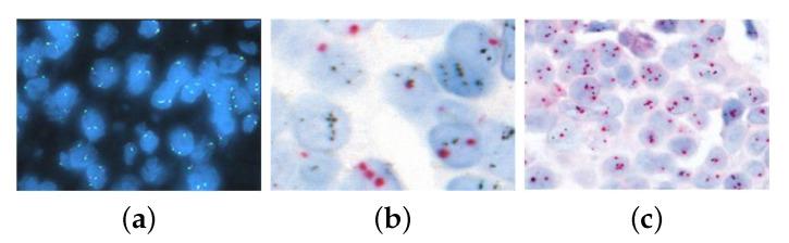 https://cdn.ncbi.nlm.nih.gov/pmc/blobs/ee6e/11430898/ee22353f8526/diagnostics-14-02089-g001.jpg