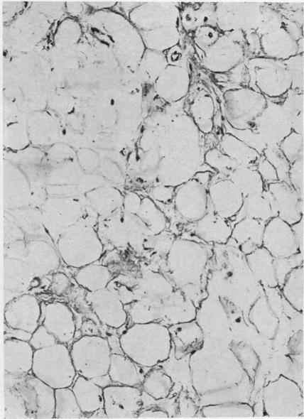 https://cdn.ncbi.nlm.nih.gov/pmc/blobs/ee70/1023944/212d3159eeaf/jclinpath00036-0005-a.jpg