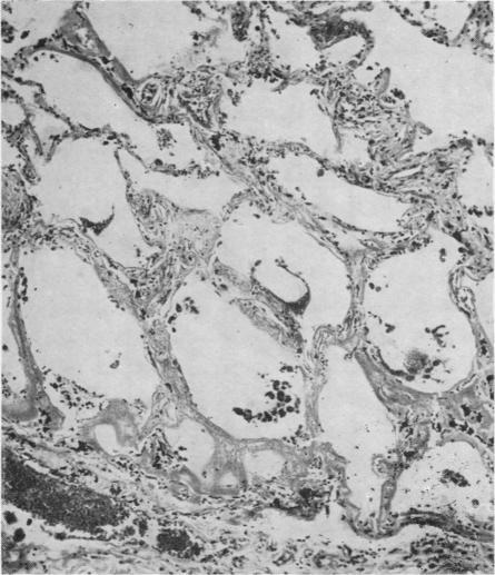 https://cdn.ncbi.nlm.nih.gov/pmc/blobs/ee70/1023944/2cfbad842151/jclinpath00036-0015-b.jpg