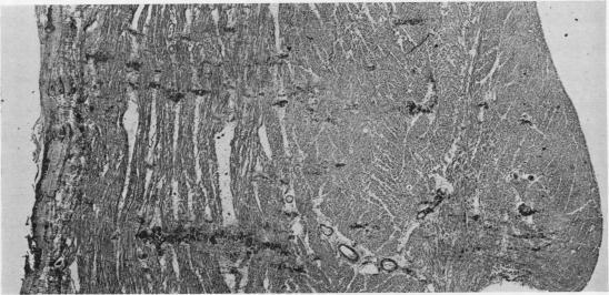 https://cdn.ncbi.nlm.nih.gov/pmc/blobs/ee70/1023944/3e3c213e2e83/jclinpath00036-0009-b.jpg