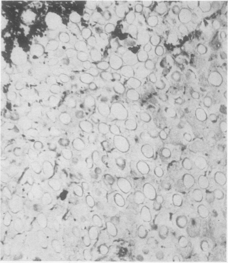 https://cdn.ncbi.nlm.nih.gov/pmc/blobs/ee70/1023944/672a18283af4/jclinpath00036-0016-b.jpg