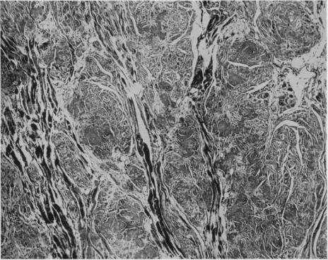 https://cdn.ncbi.nlm.nih.gov/pmc/blobs/ee70/1023944/e26ac75833a7/jclinpath00036-0013-a.jpg