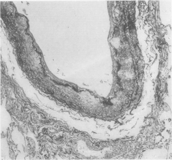 https://cdn.ncbi.nlm.nih.gov/pmc/blobs/ee70/1023944/f61a7fdfb665/jclinpath00036-0006-b.jpg