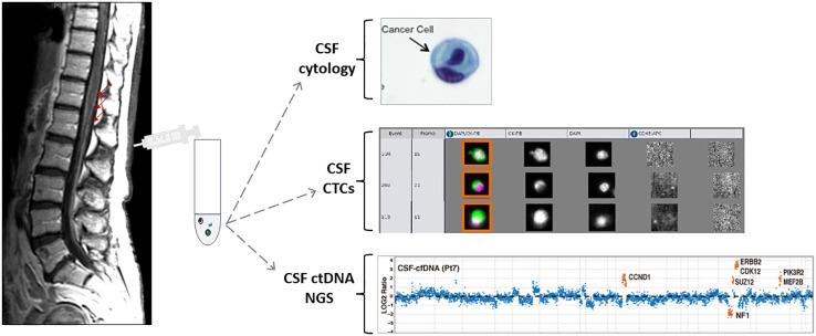 https://cdn.ncbi.nlm.nih.gov/pmc/blobs/ee76/11471434/44671f5b0a88/fonc-14-1409383-g002.jpg